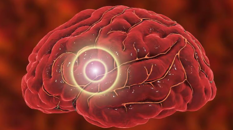 Illustration of a brain with a highlighted area